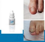 Spray Utrile contro i funghi