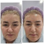 MASCHERA INVISIBILE PER VISO (scatola 5pz) - immagine 2